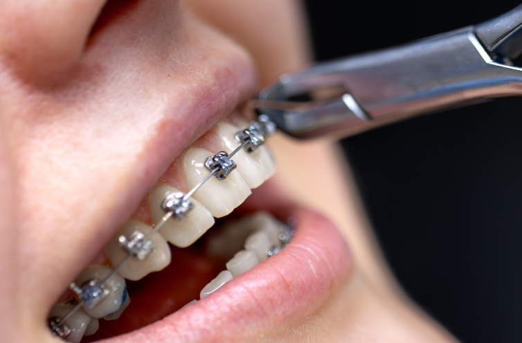 Southgate-Dental-gallery-img-1