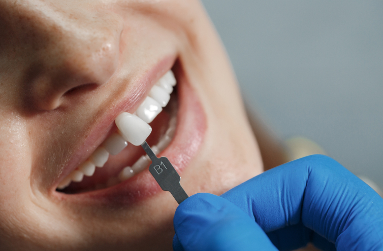 Southgate-Dental-gallery-img-4