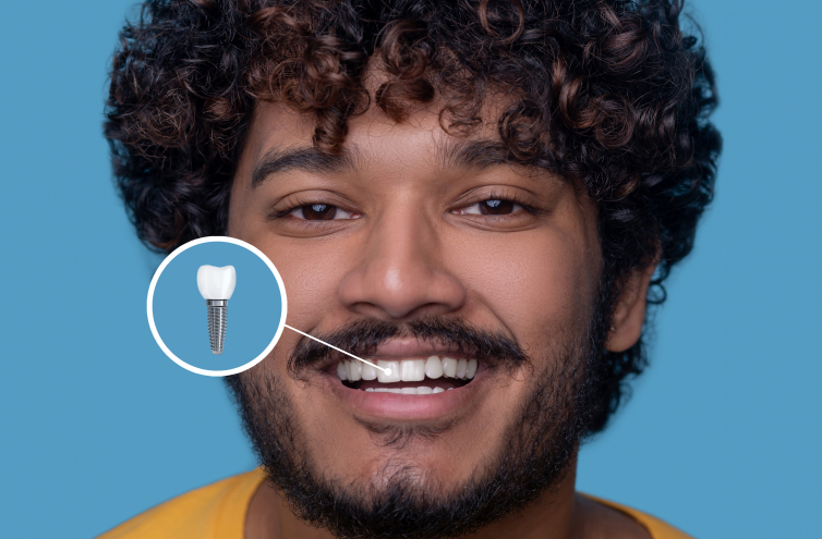 Sparkling-Smile-Dental-San-Jose-gallery-img-3